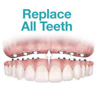 replace all teeth